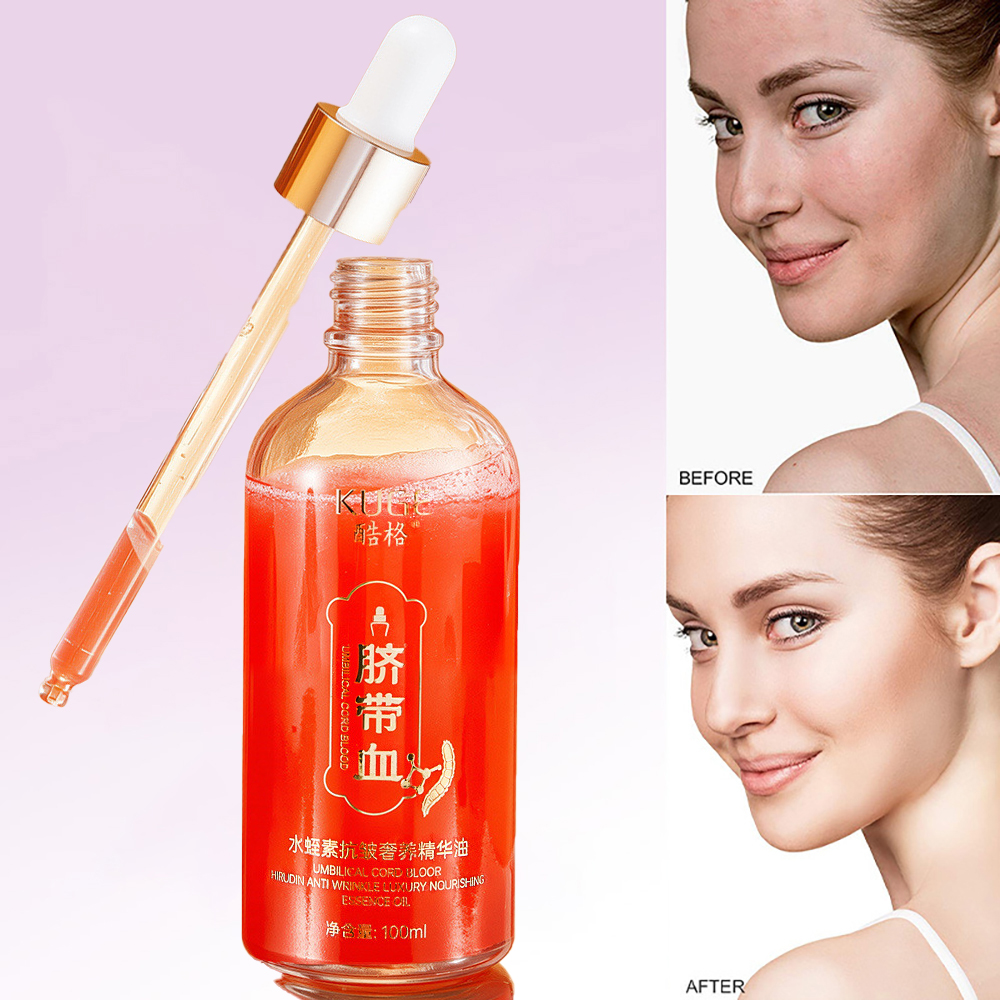 Luxury Skincare Products For Women - 100ml Umbilical Cord Blood Hirudin Aanti
