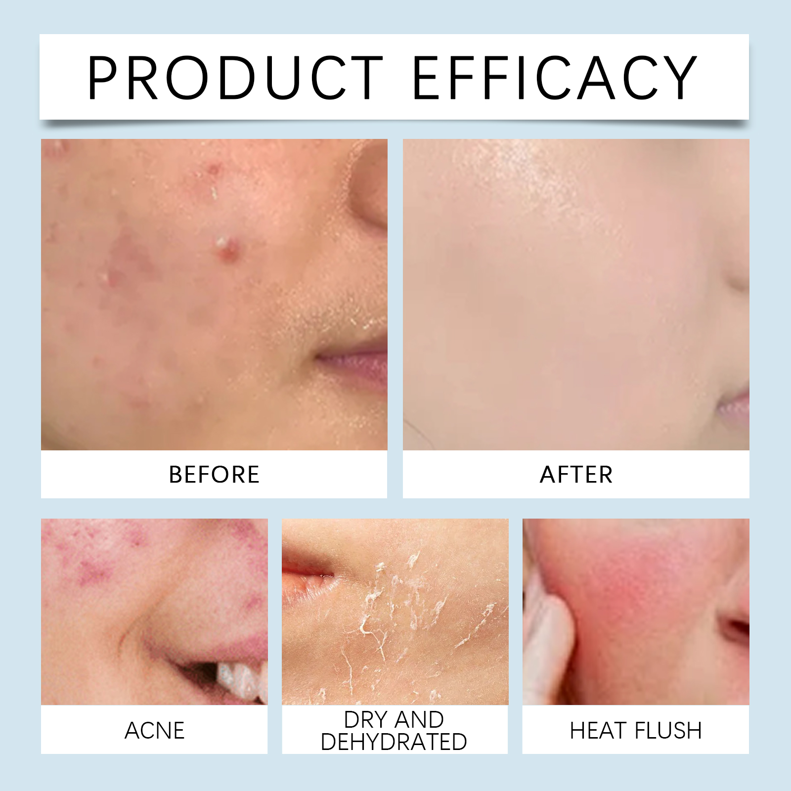 Hydrating roller Serum 0.25mm  - Luxury Skincare Serum recensie en prijs