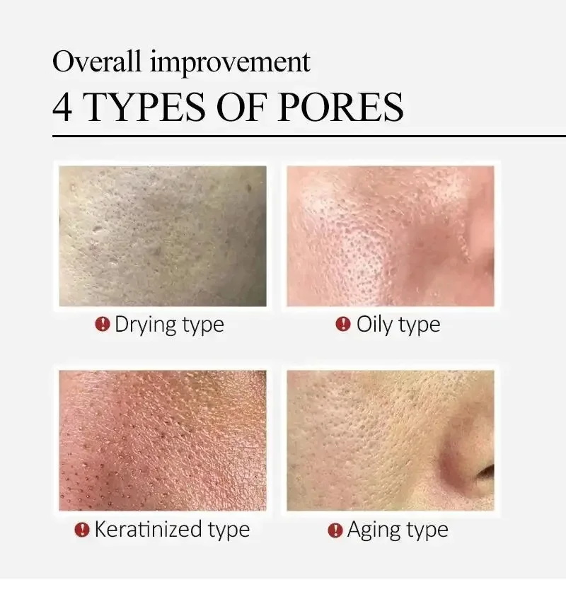 Centella Asiatica Shrink Pores - Luxury Skincare Korea recensie en prijs